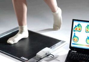 Diagnoza hallux valgus